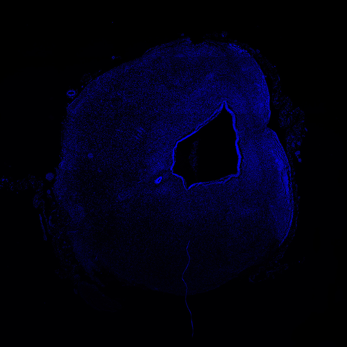 Human foetal midbrain